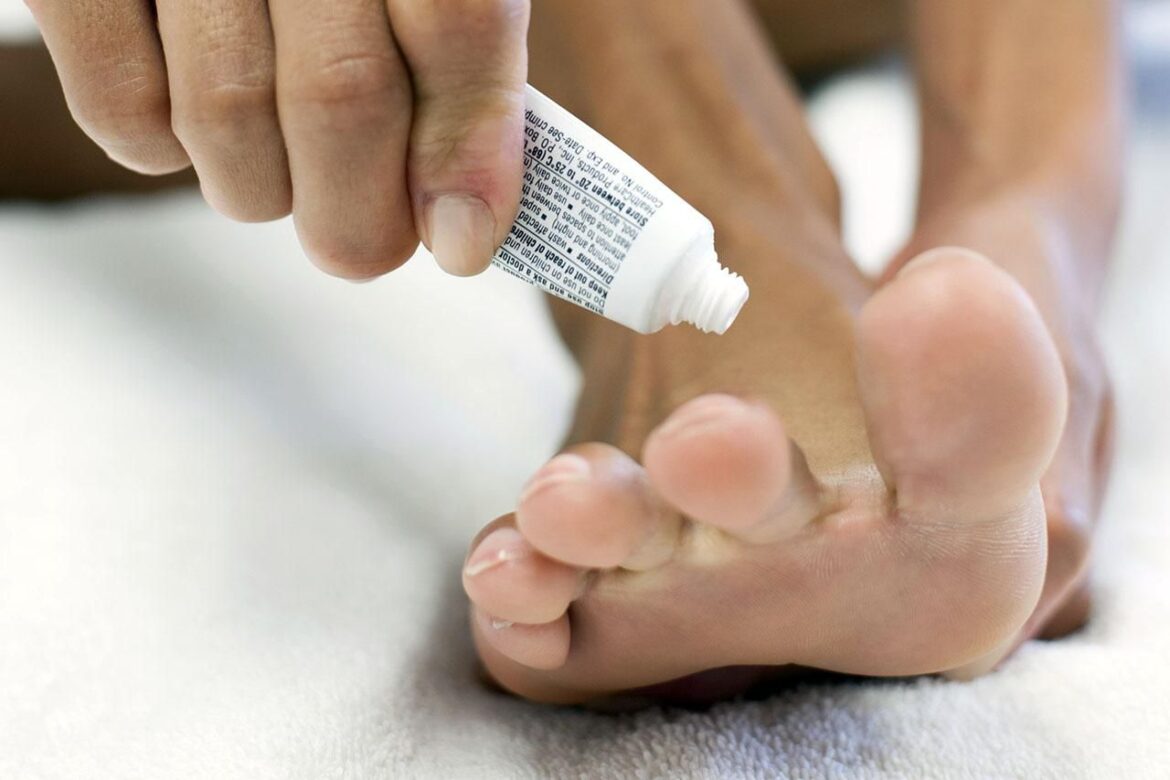 What Causes Burning Sensation In Big Toe