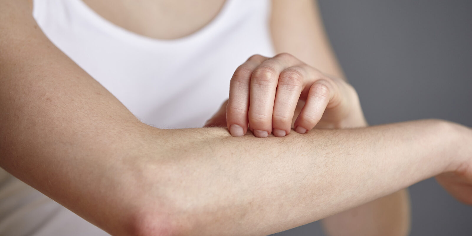Rash on Arm Causes Itchy, Red, Treatments, and Remedies American Celiac
