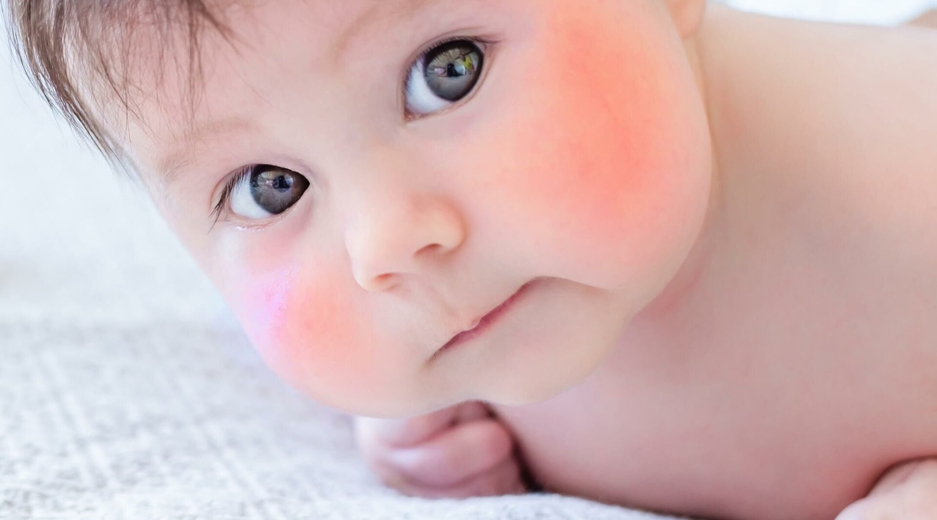 Swollen Cheeks Causes Red In Toddler And Inside Mouth American Celiac