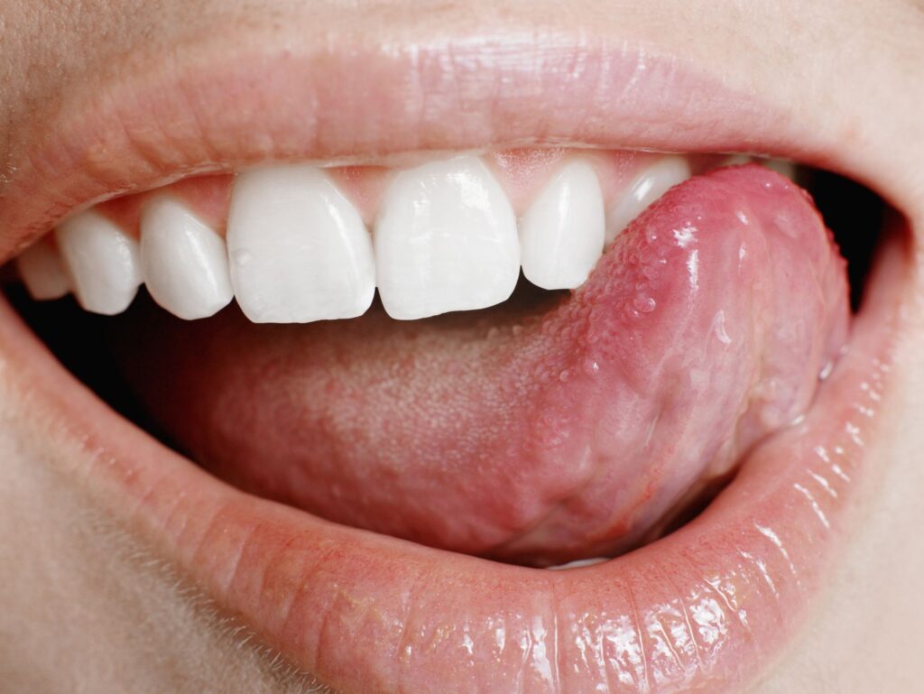 Small Big Sore Red Spots On Tongue Cause And Meaning American Celiac 2976