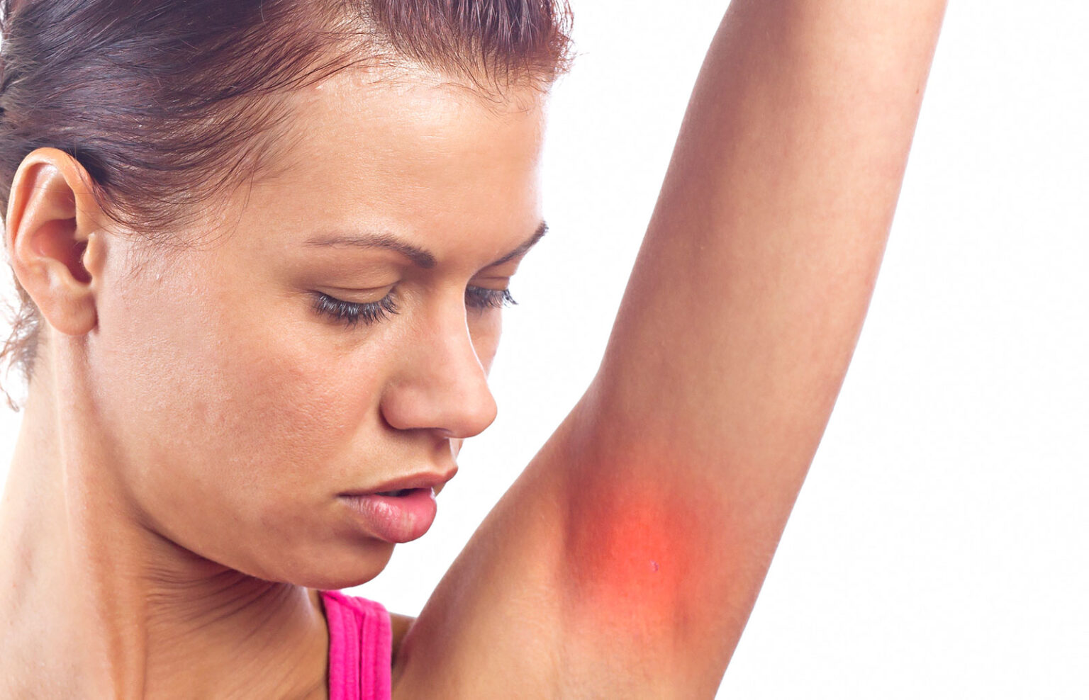 Underarm Rash Causes, Pictures, Painful, Red & Itchy Rash Treatment