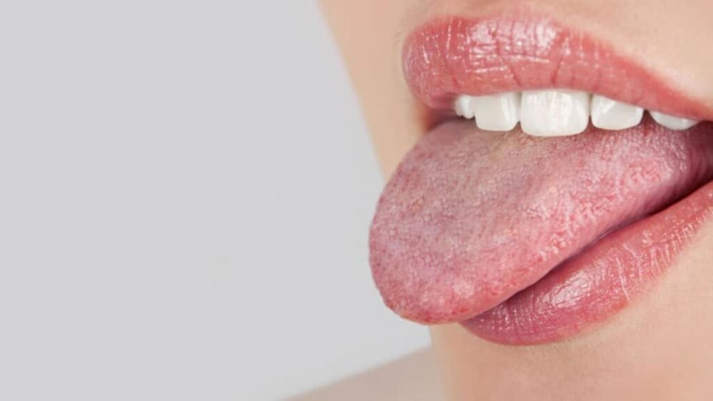 swollen-taste-buds-causes-getting-rid-of-tip-back-tongue-enlarged