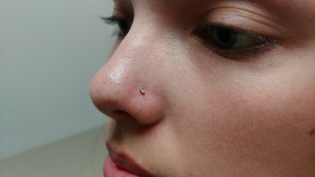 Infected Nose Piercing Pictures, Symptoms, Treatment, Bump, Home