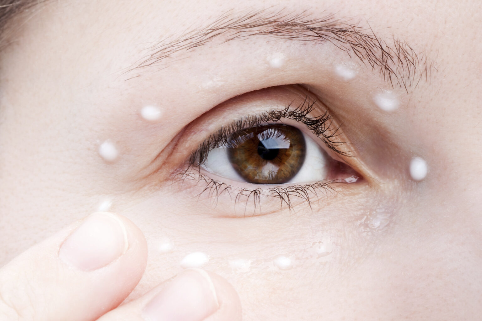 Oily Eyelids Symptoms, Causes, Treatment and Remedies American Celiac