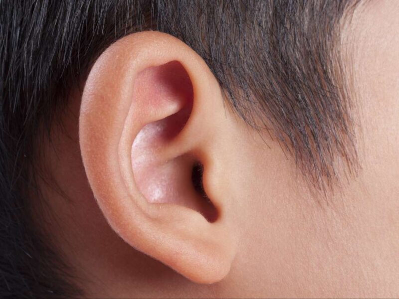 Blackheads in Ear, Behind, In Ear Canal, How To Get Rid of Blackheads