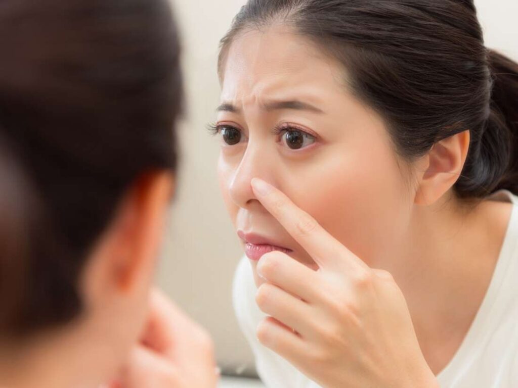 pimple-on-nose-causes-how-to-get-rid-of-big-cystic-pimple-on-nose