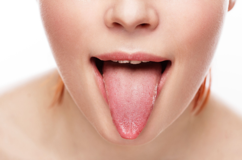 Tongue Swelling Causes Symptoms Treatment Piercing Under And One Side American Celiac