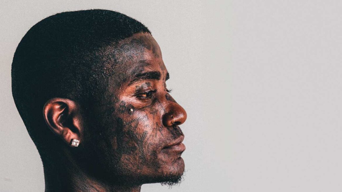 Cheek Piercing Dermal, Dimple, Cheekbone, Pictures, Jewelry, Scars