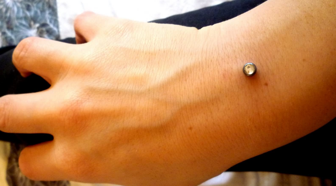 Microdermal Piercing Price, Pictures, Removal, Jewelry, on Hip, Neck