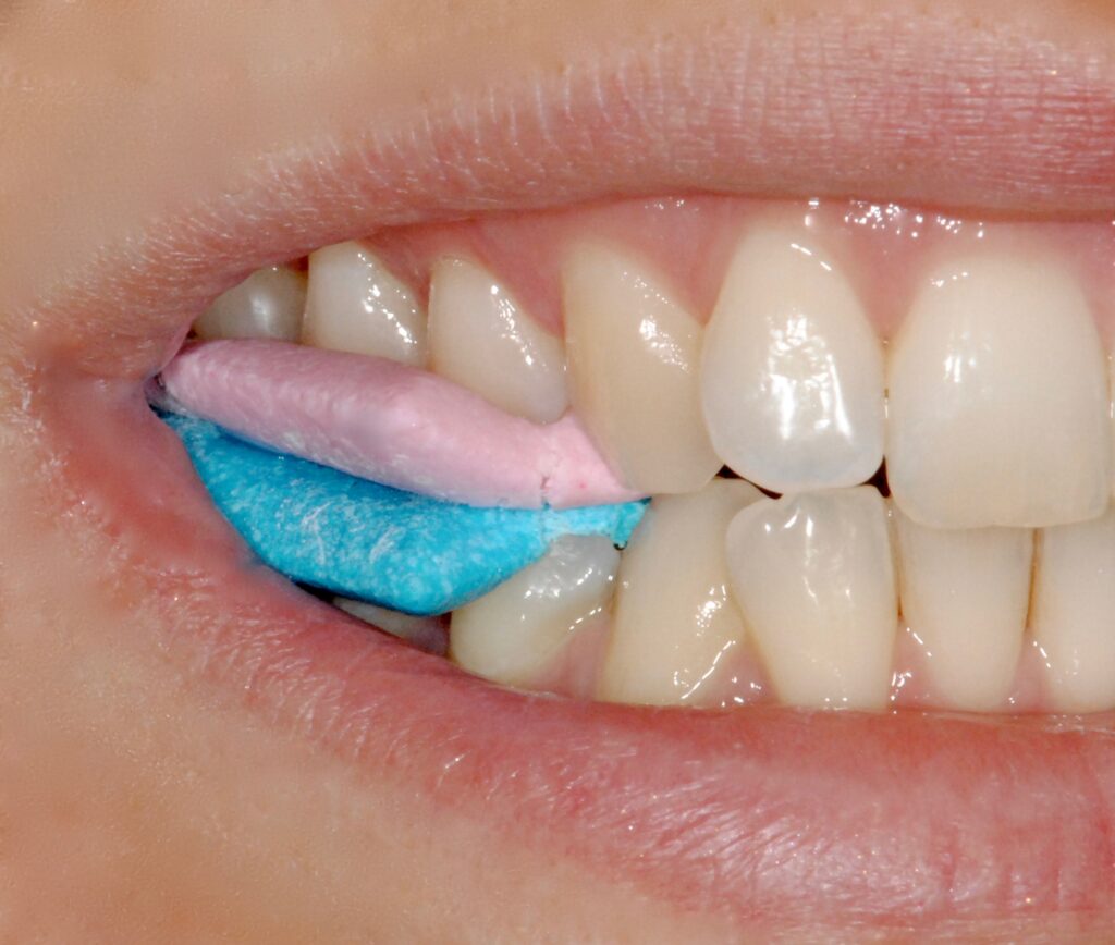 pin-on-dental-conditions