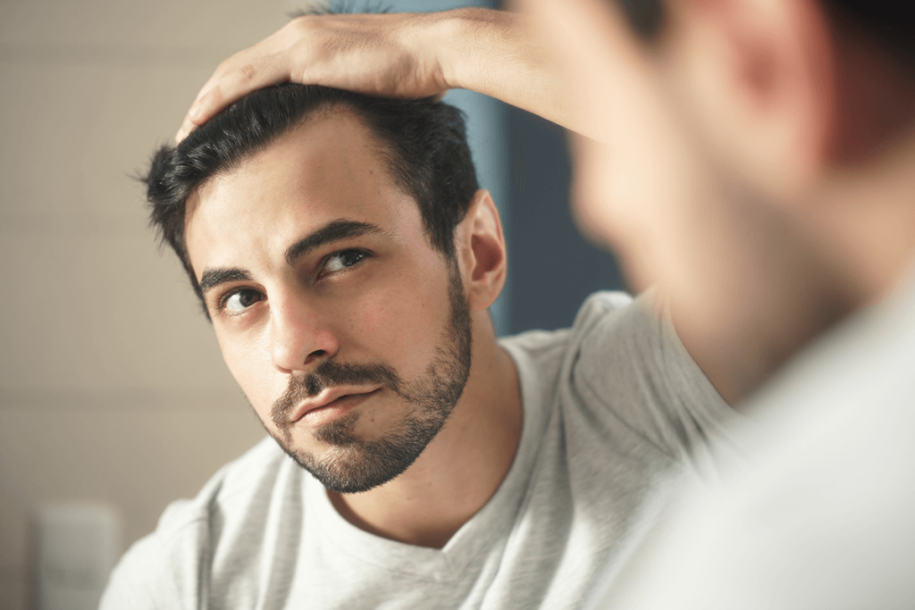 Receding Hairline Meaning Types Causes Regrowth Treatments And Remedies American Celiac