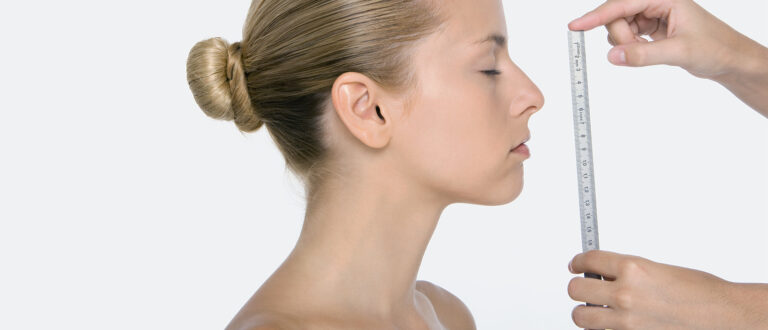 Receding Chin Causes, Meaning, Pictures, Correction Surgery And Baby ...