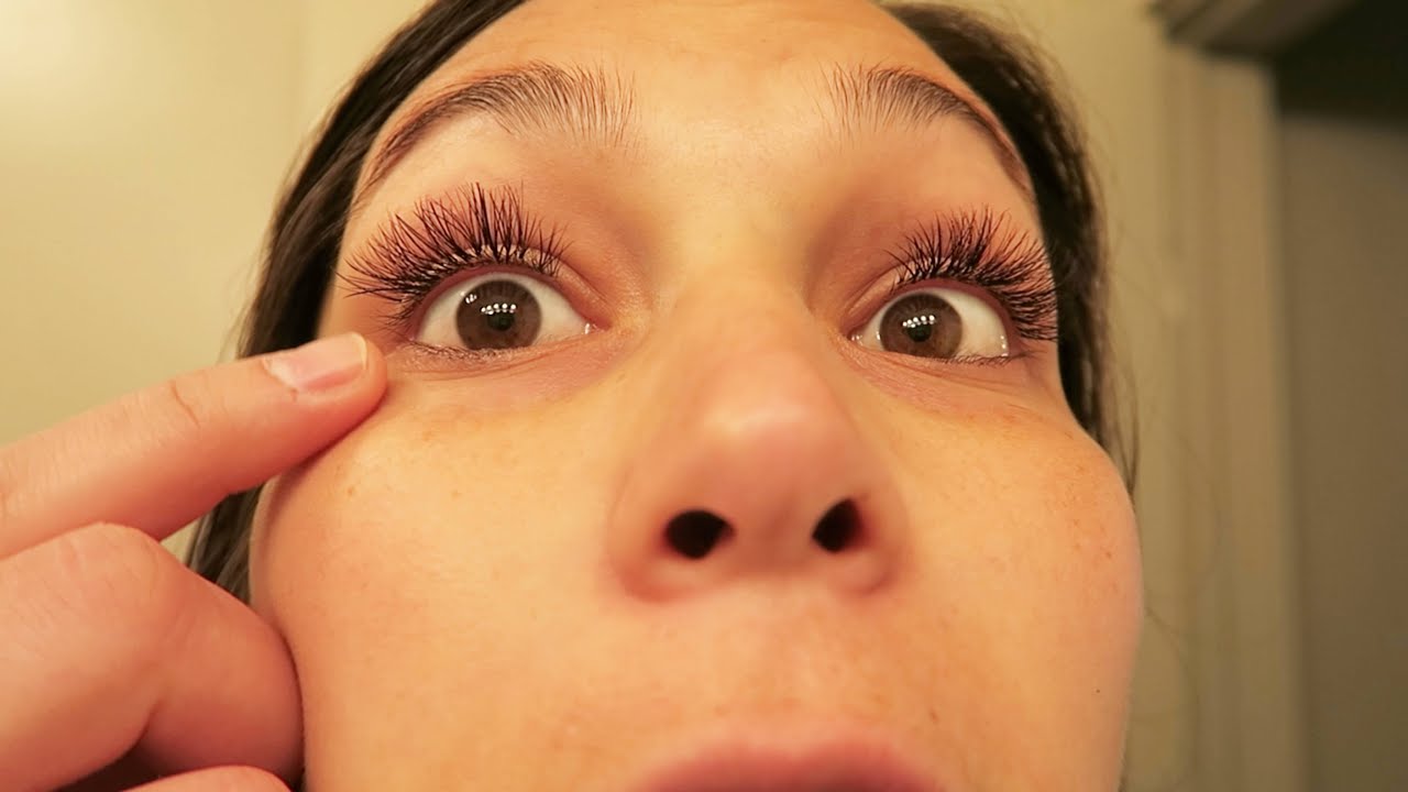 Why Are My Eyelashes Falling Out Loss Causes How To Stop Regrow Eyelashes American Celiac 