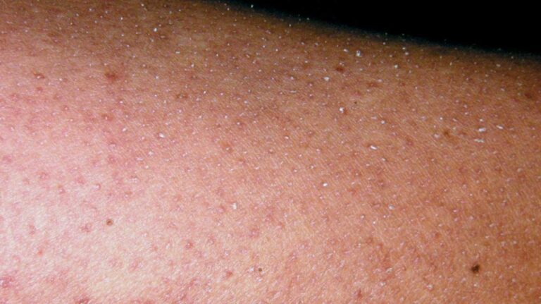 red-spots-on-legs-causes-pictures-including-small-itchy-non-itchy