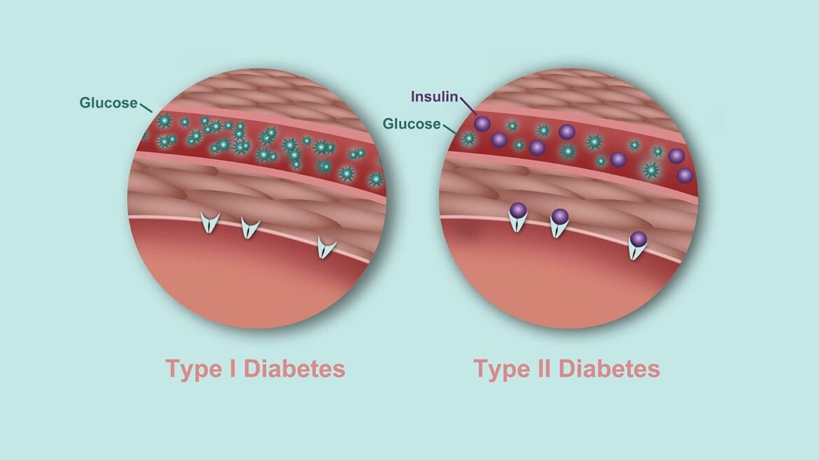 night sweats diabetes