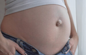 Belly Button Discharge – Causes, Yeast, Smelly White, Brown, Yellow