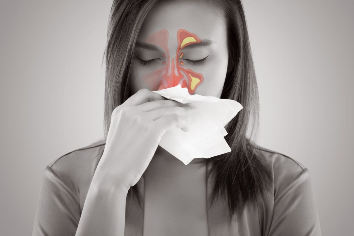 如何控制潍坊过敏性鼻炎对身体的危害 - 知乎
