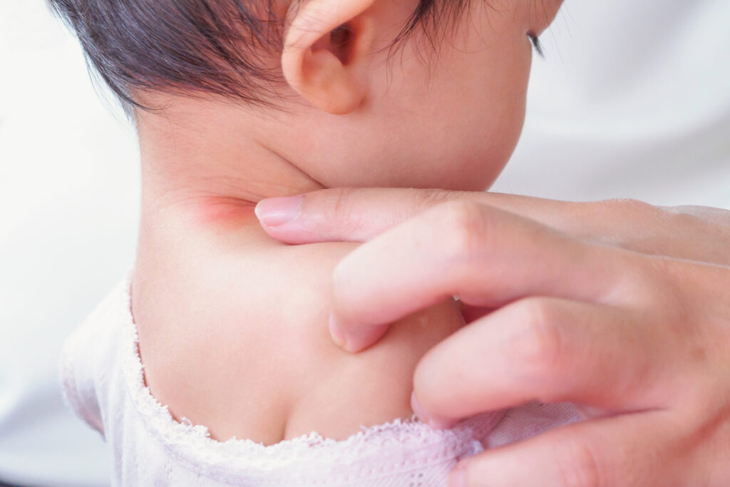 Rash on Neck Meaning, Causes, Itchy, Red, Bumpy Rash, Diagnosis and