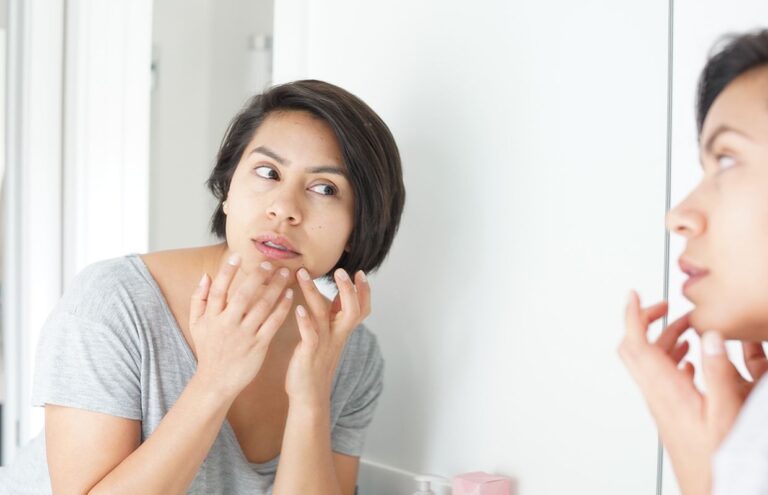 Blackheads On Lips Causes Treatments Home Remedies And Preventions