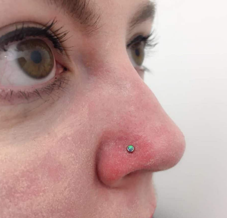 Redness around Nose Causes and How to Get Rid of Red, Dry Skin on Nose Is It Normal For Nose Piercing To Sink In