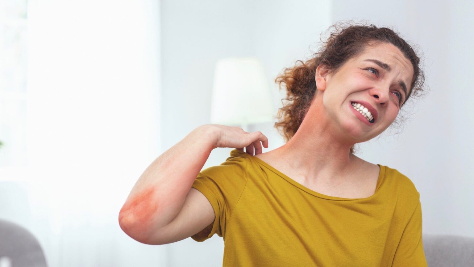 Why Does Sunburn Itch, Severe, Unbearable & Treatment of Itchy Sunburn