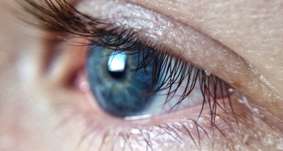 Eyebrow Mites Pictures, Facts, Symptoms and Treatments of Domedex