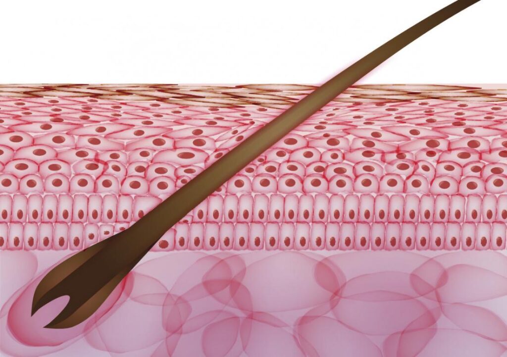 Fordyce Spots on Shaft Meaning, Causes, Symptoms, Treatment and Natural