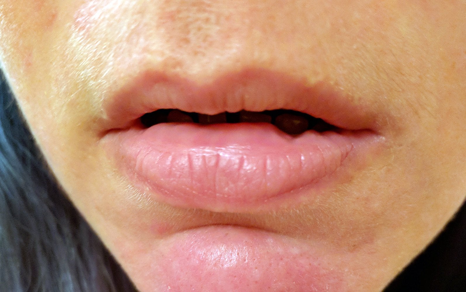 Why and How to Stop Biting Inside of Lips, Signs and Effects - American ...