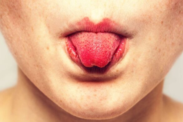 Face Swelling With Rash, Causes, Symptoms, Treatments