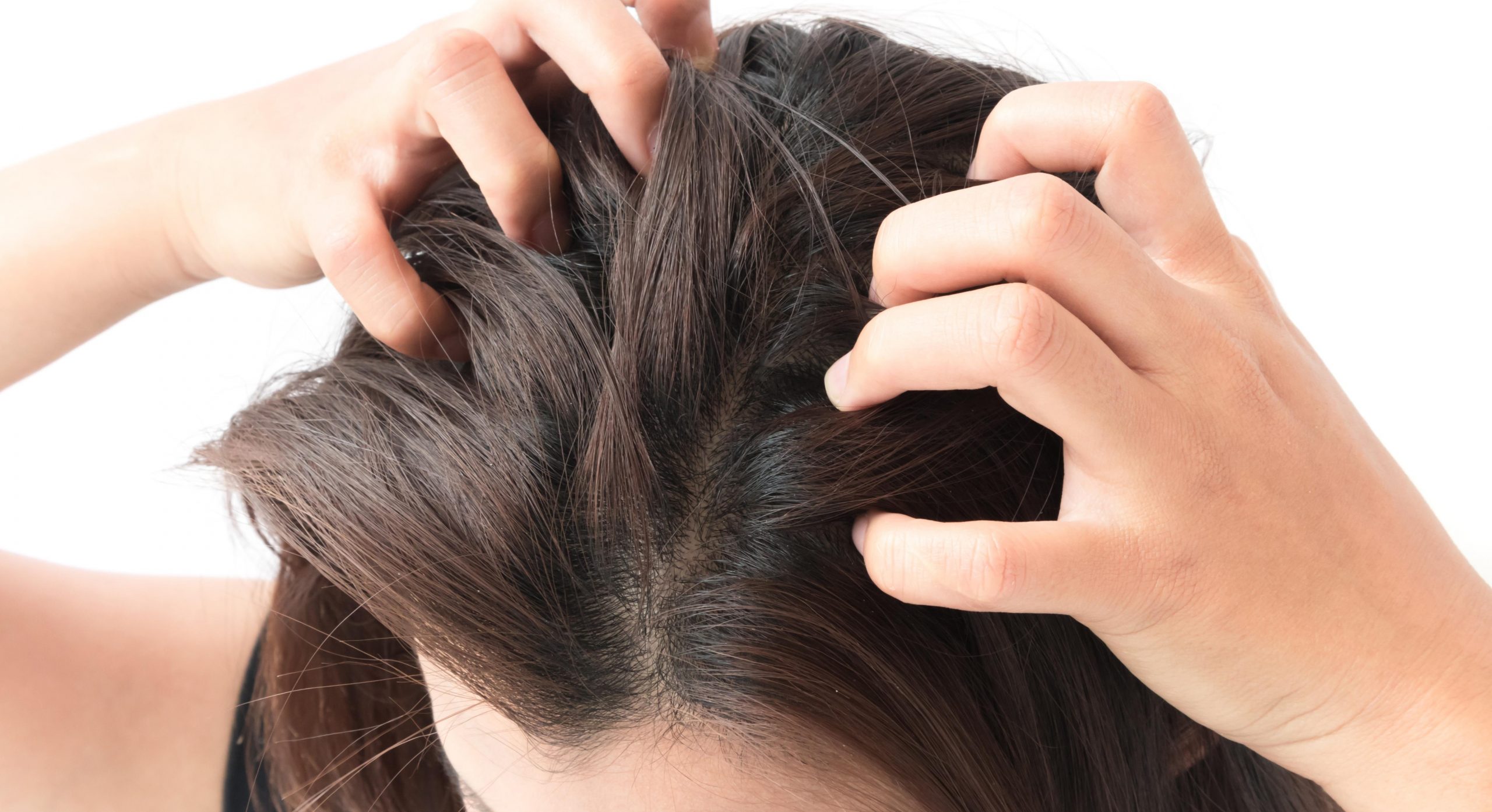 What Causes Itchy Bumps On The Head