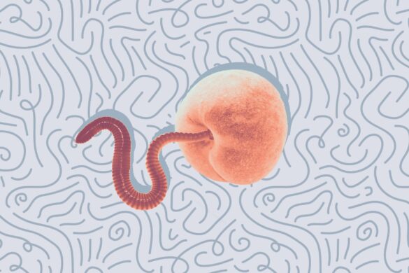 Threadworms Archives - American Celiac