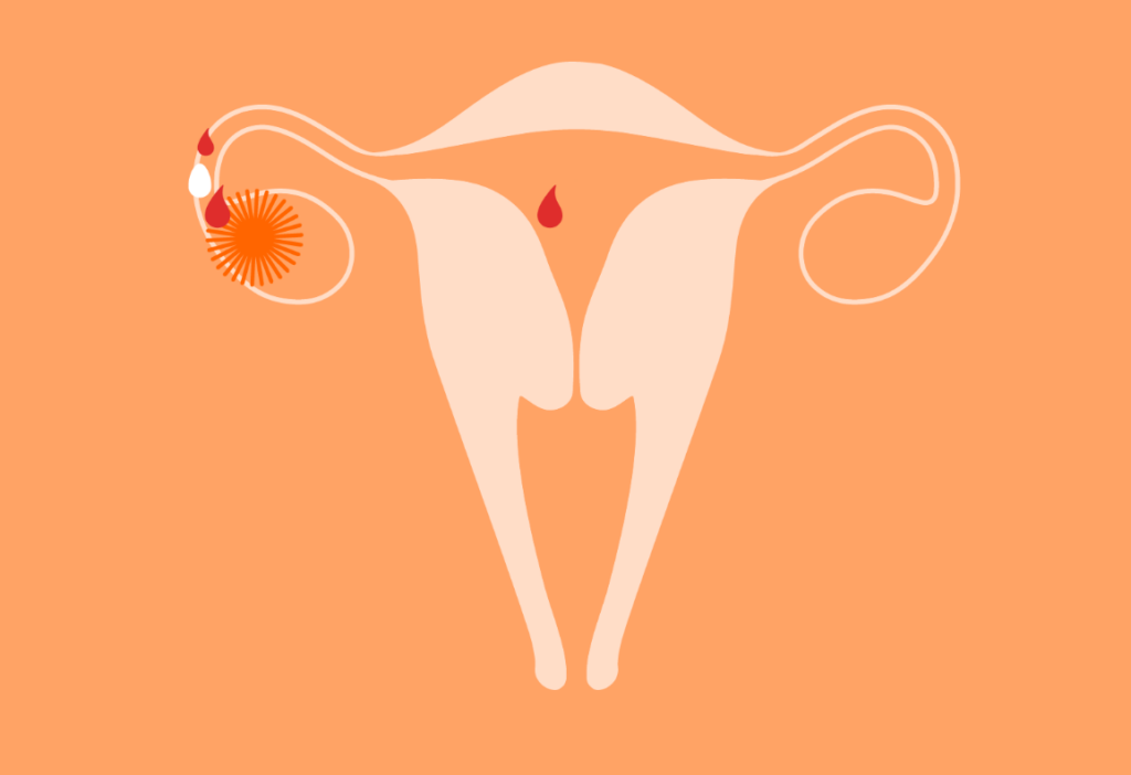 spotting-during-ovulation-possible-causes-faqs-american-celiac