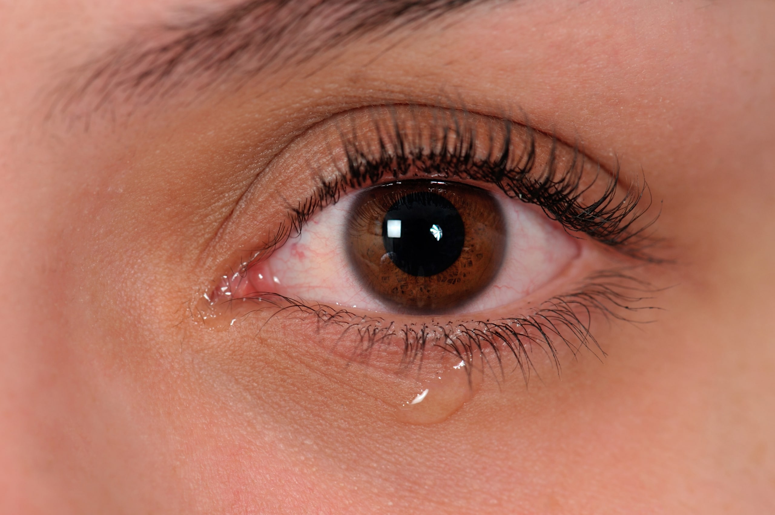 Заплаканные глаза девушки карие