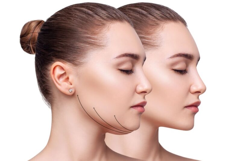 Customized Solutions for Facial Contouring