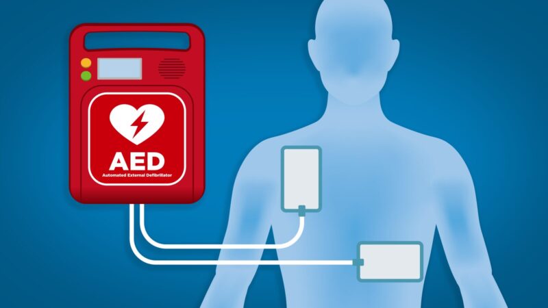 Where to Find an AED