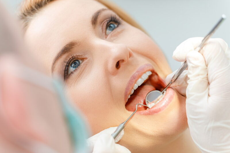 Close-up partial view of beautiful middle aged woman at dental c